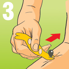 Schritt 3: Hebel an Zeckenkopf anbringen